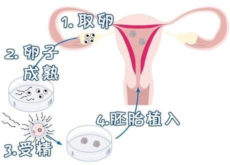 关于有偿代孕服务方式